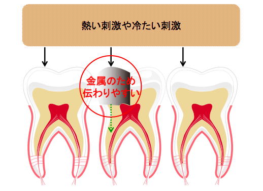 歯