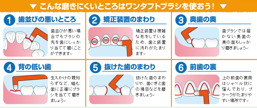 ワンタフトブラシでの歯磨きーノーブルデンタルクリニック仙台 仙台駅東口 日曜診療 夜間診療