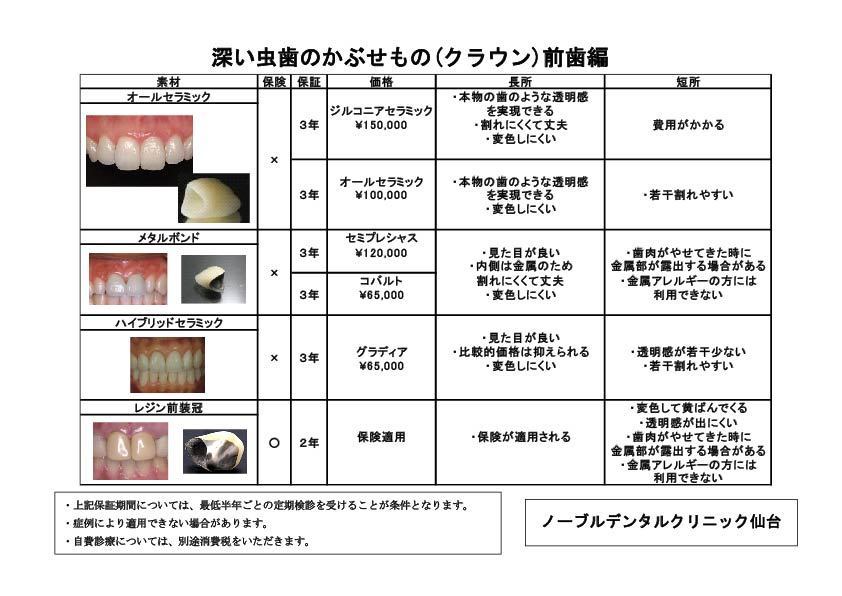 歯 かぶせ もの 値段