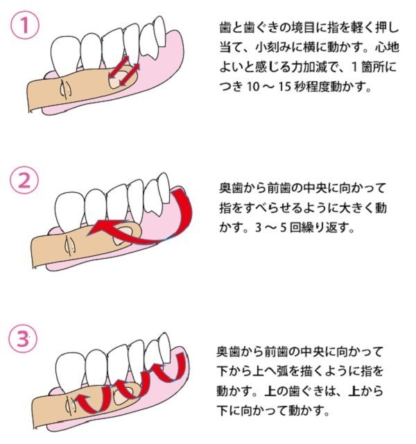 歯周病とリペリオーノーブルデンタルクリニック仙台 仙台駅東口 日曜診療 夜間診療