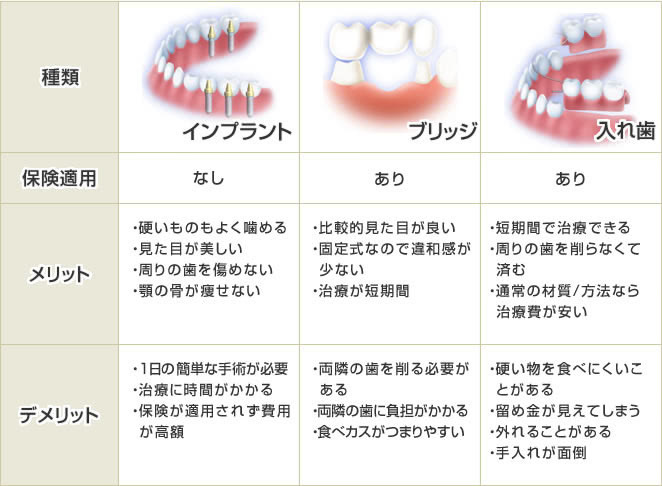 奥歯 が 欠け た 治療 費 保険