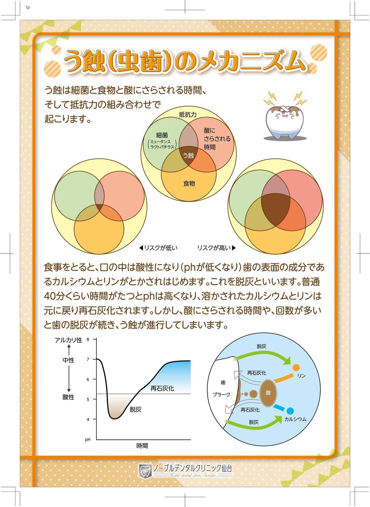 虫歯のメカニズム 虫歯のメカニズム