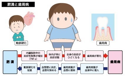歯周病と全身疾患 肥満