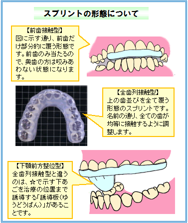 スプリントの種類