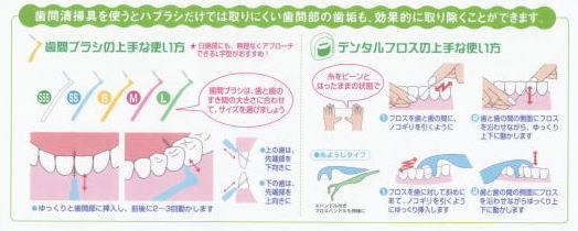 歯間ブラシとデンタルフロスの使用法