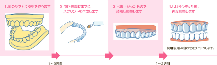 顎関節症に対するスプリント療法～簡便なスプリントの作製法と歯リハ２の対応法～