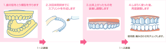 顎関節症のスプリント治療ーノーブルデンタルクリニック仙台