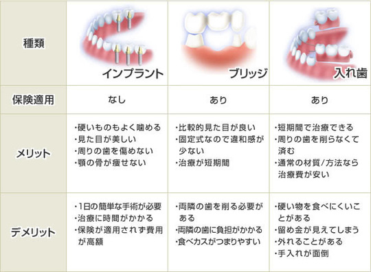歯が欠けた時の治療(抜歯)ーノーブルデンタルクリニック仙台(仙台駅